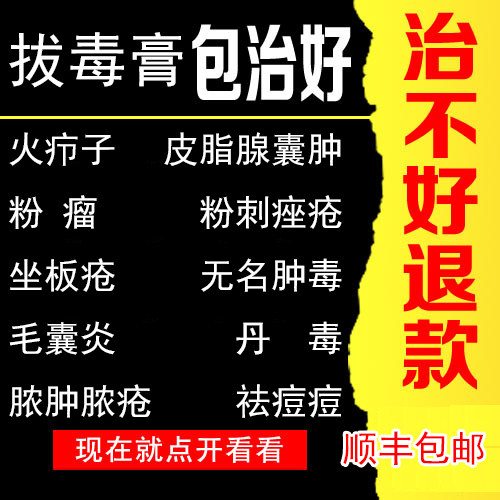 祛火疖子拔毒拔脓膏皮脂腺囊 肿粉 瘤丹 毒坐板疮肿毒毛囊 炎粉刺