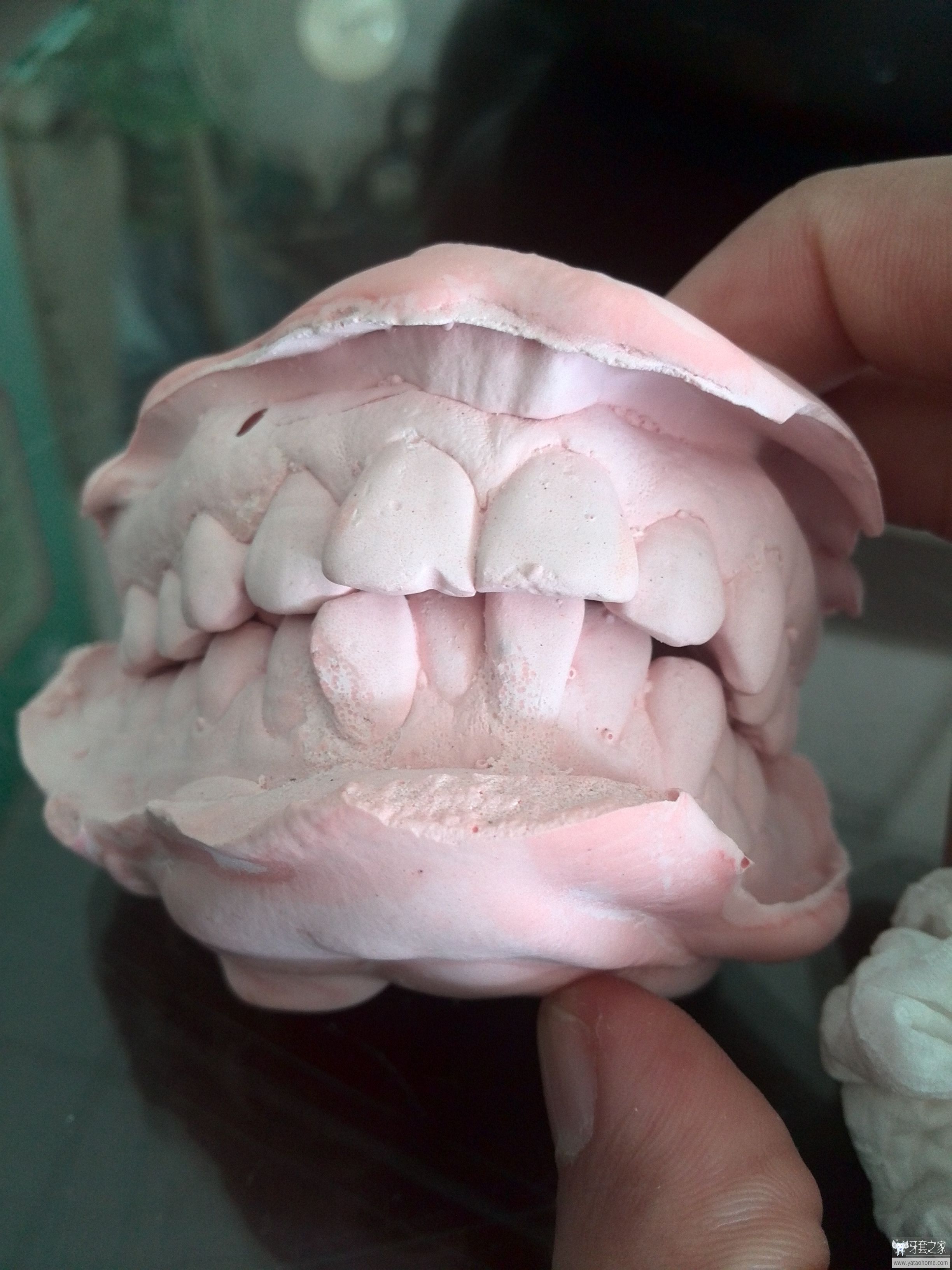 牙石膏模型,上颌牙石膏模型图片,牙模石膏(第15页)_大山谷图库