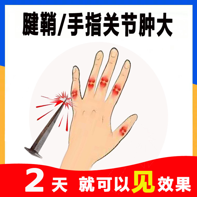 共111 件手指关节炎痛贴膏相关商品