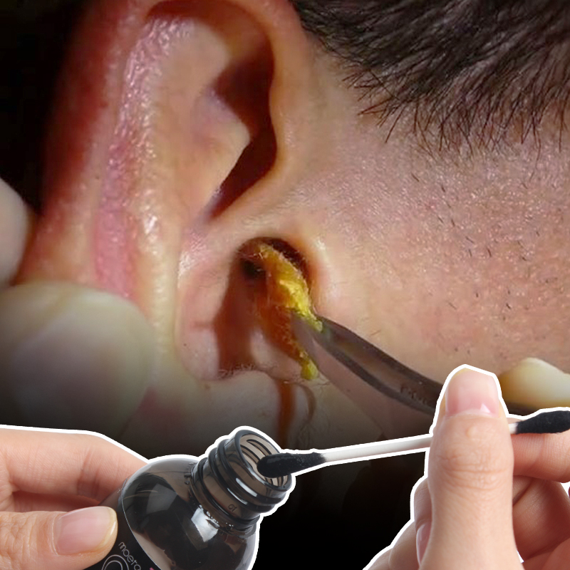 韩国儿童宝宝耳屎软化液婴幼儿掏耳神器清洁器油耳朵捞耳勺掏耳朵