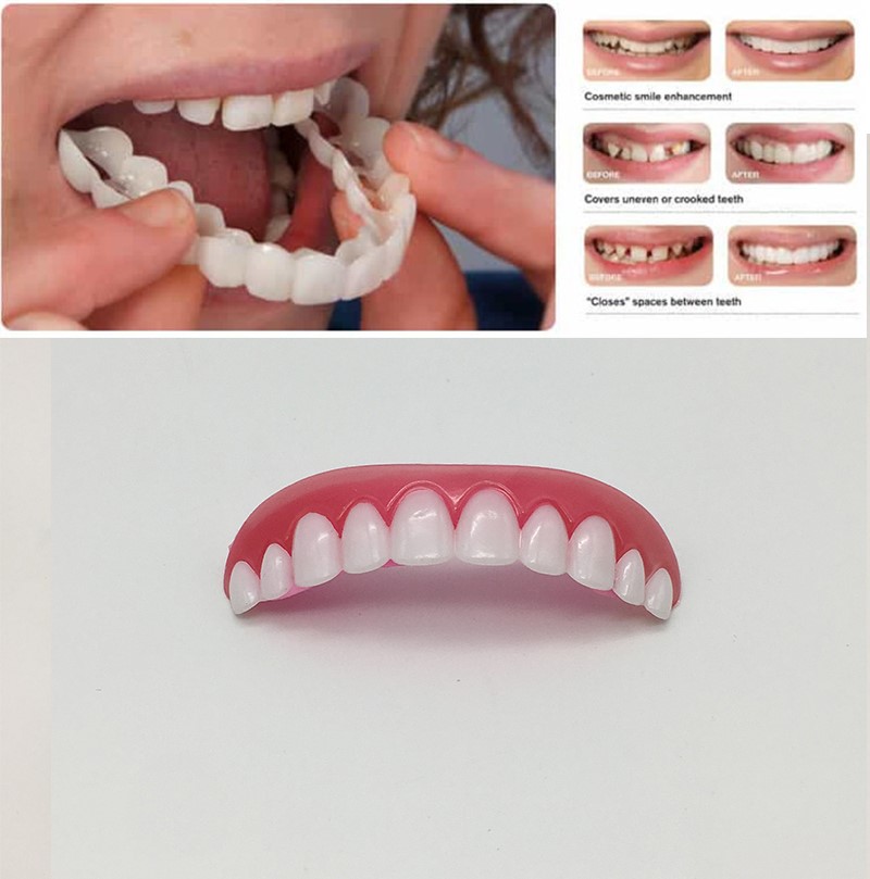 缺牙临时牙套门牙 遮盖自制模型贴片美白牙贴缺牙补门牙自补假牙