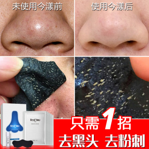 去黑头收缩毛孔套装女学生鼻贴男女士撕拉式强力祛黑头神器强效去黑头套装